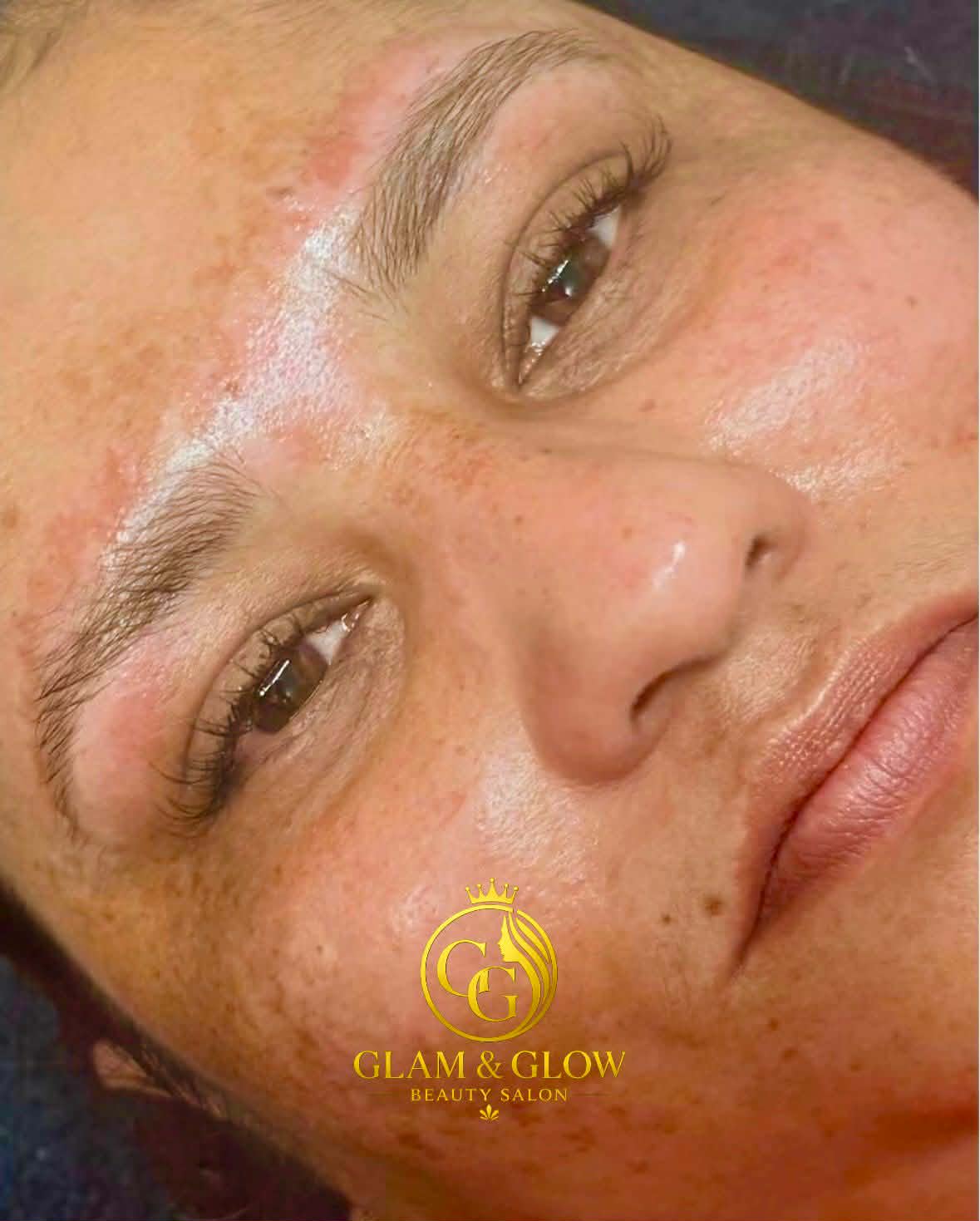 Glow Facial